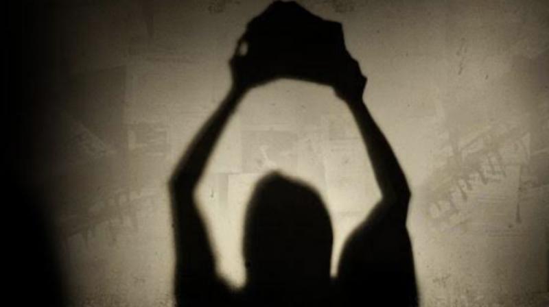 Representative Image.