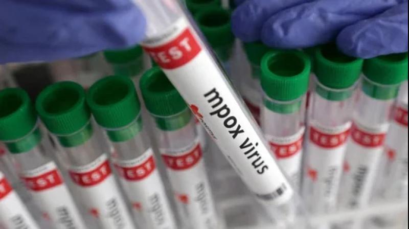 Representative Image.