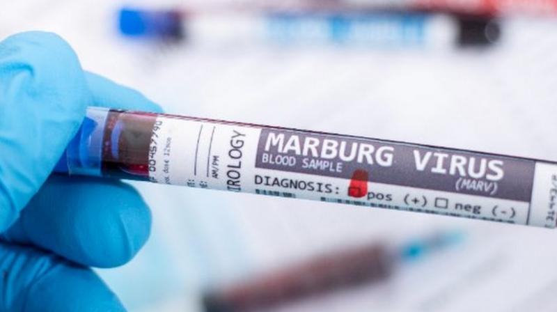 Marburg virus