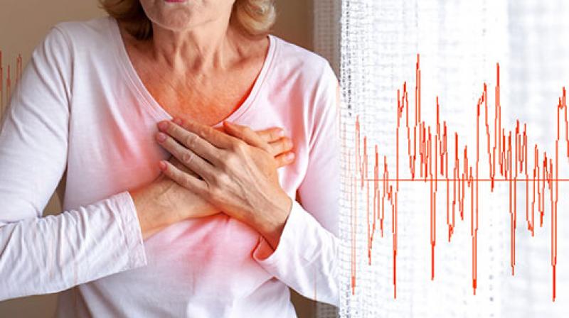 Representative Image.