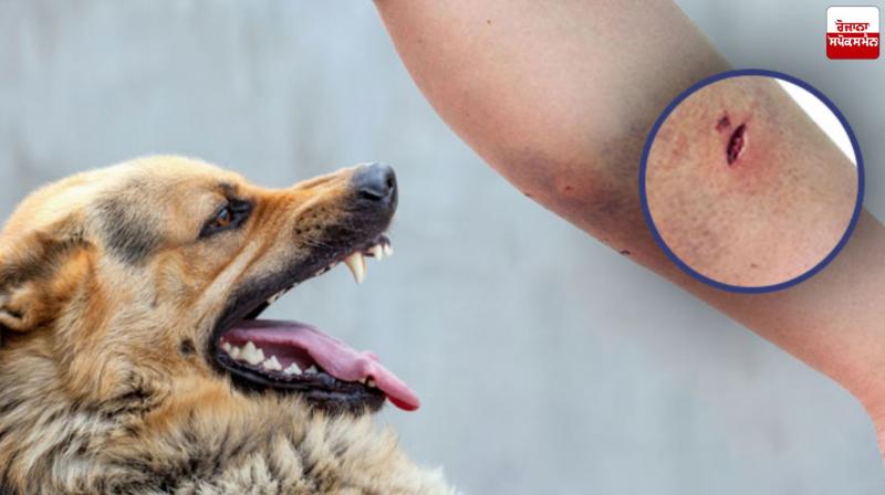 10,000 People Are Killed by Dogs Everyday in India : TOI Report Latest News in Punjabi