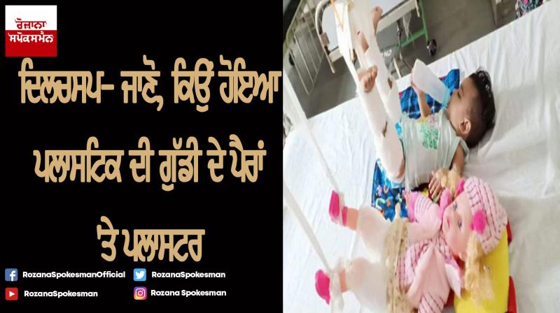 to fix 11 month olds fracture doctors first had to plaster her doll