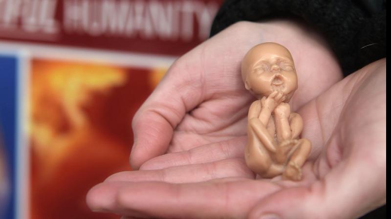  50-year-old abortion rights may end in US 