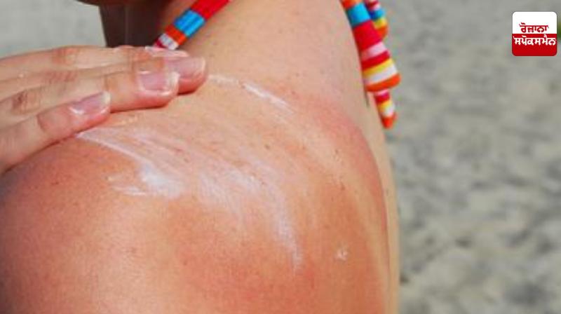 Home remedies for sun-tanned skin