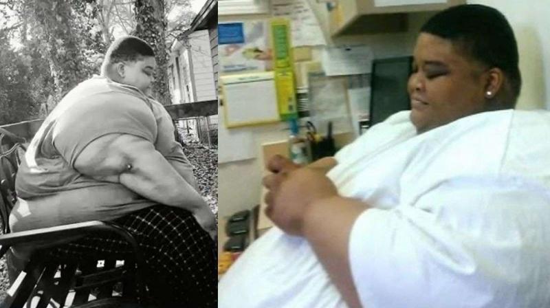 300 kg Nicholas lost 165 kg in 4 years, doctors said he was a ticking time bomb