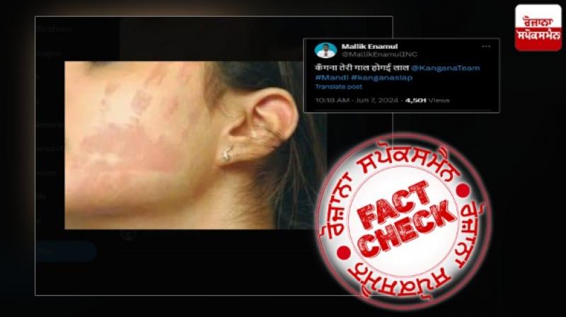 Old image from Baygon Slap advertisement viral as Kangana Face Slap marked by CISF Officer