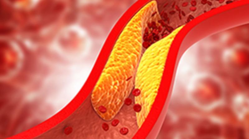 If you also have high cholesterol, stop doing these things