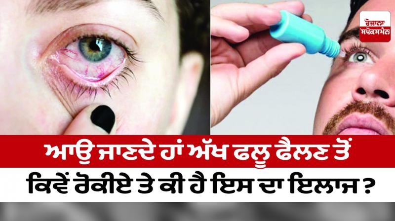 How to prevent the spread of eye flu