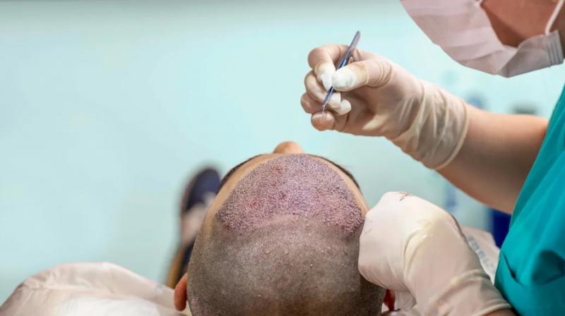 Dentists are treating baldness, death is happening, appearance is distorted