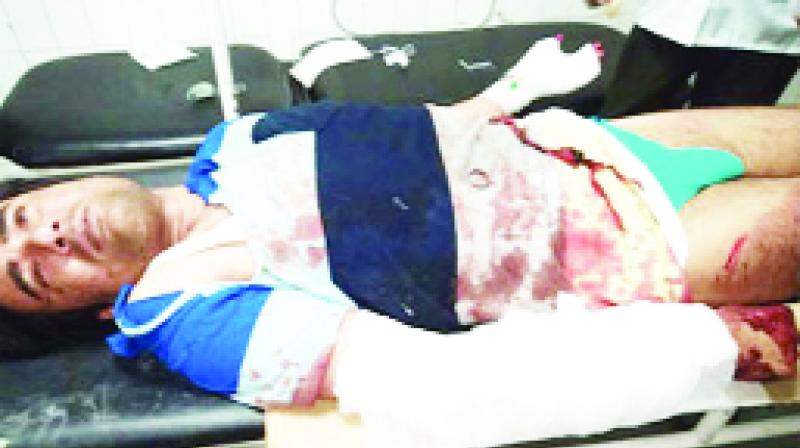 Pulkit In Serious Condition Injured