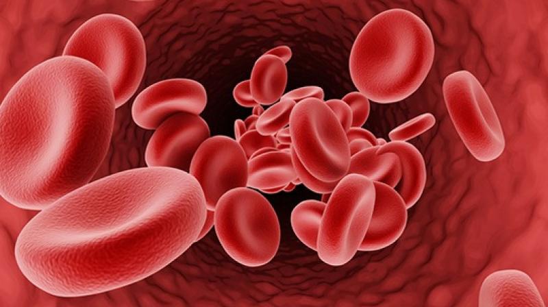 Thalassemia 