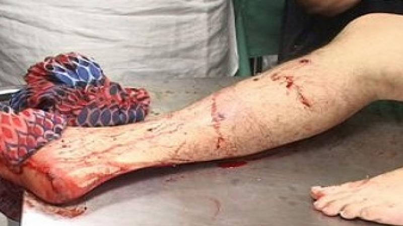 Congress leader shot by strangers