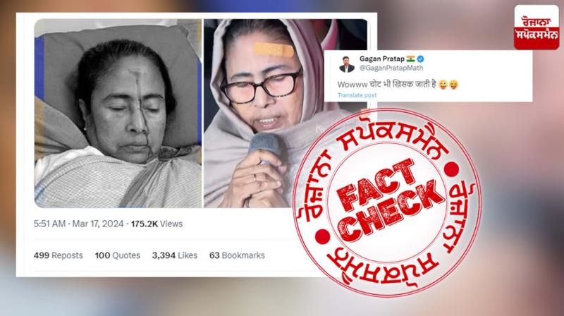 Misleading Post Viral Defaming Mamata Banerjee Claiming Her Injury Is Fake