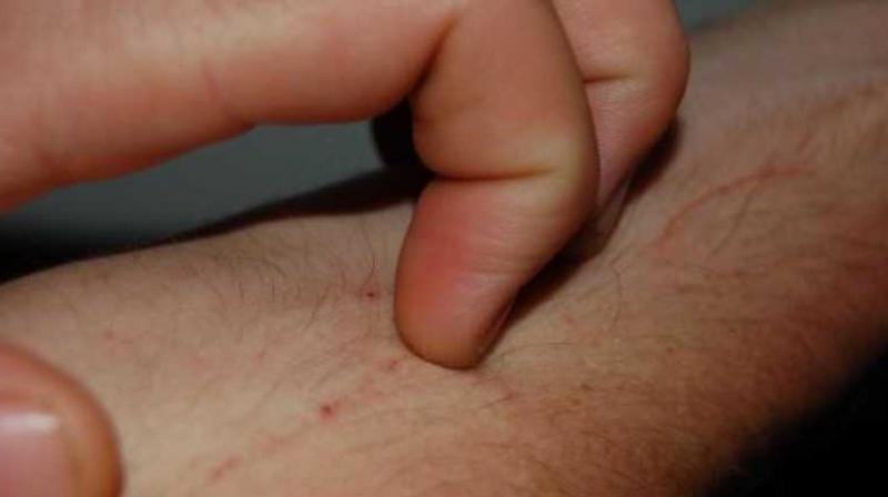 Image for representation purpose only