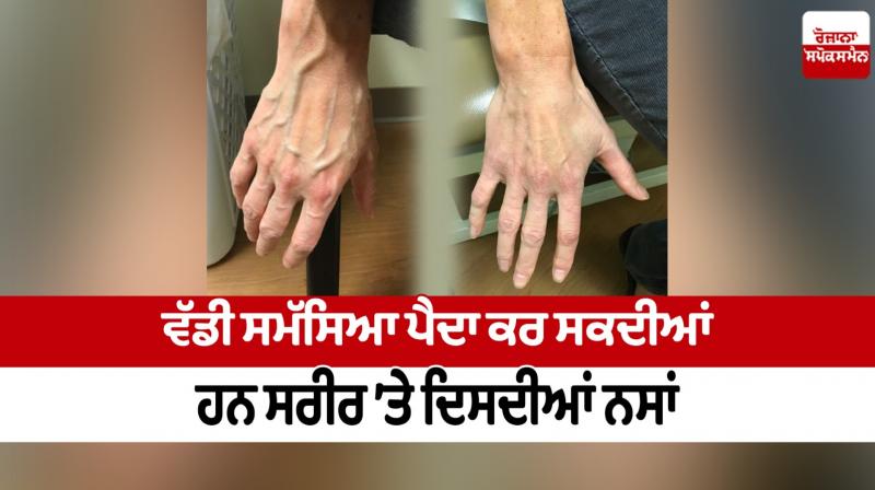 Nerves visible on body can cause a big problem