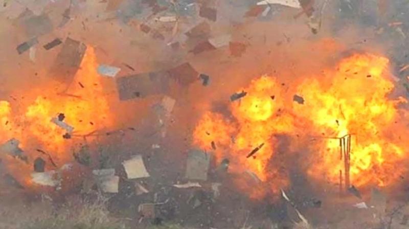 Representative Image.