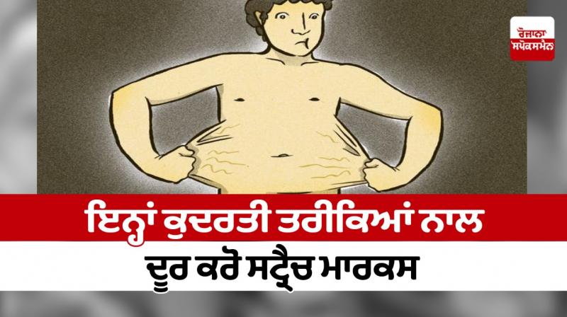 Get rid of stretch marks with these natural methods