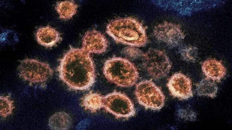  Zoonotic Langya Virus Found in China