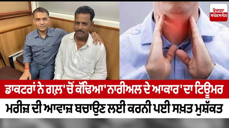 ‘Coconut size’ tumor removed from man's thyroid gland at Delhi 