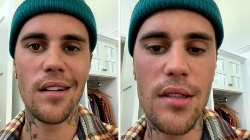 Justin Bieber reveals facial paralysis after shows cancelled
