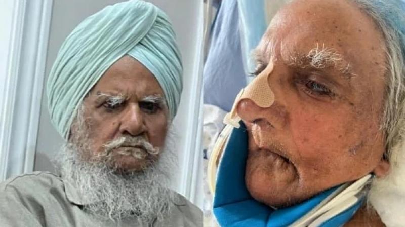 Disrespect of cases in Brampton city, 85-year-old doctor cut off beard and cases during treatment