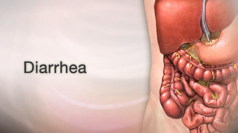  Health crisis in Pakistan after flood, 90 thousand cases of diarrhea in 24 hours
