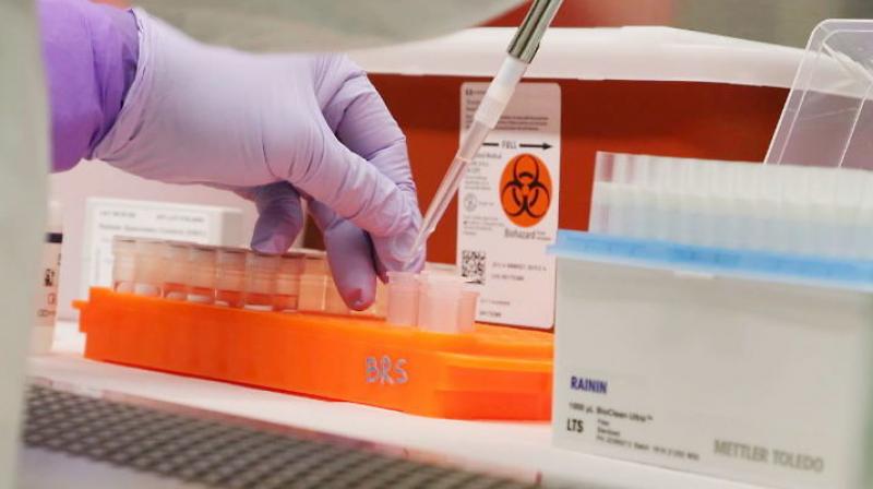 Who recommends on coronavirus sampling