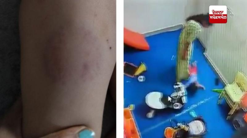 Case registered against daycare and attendant in Noida