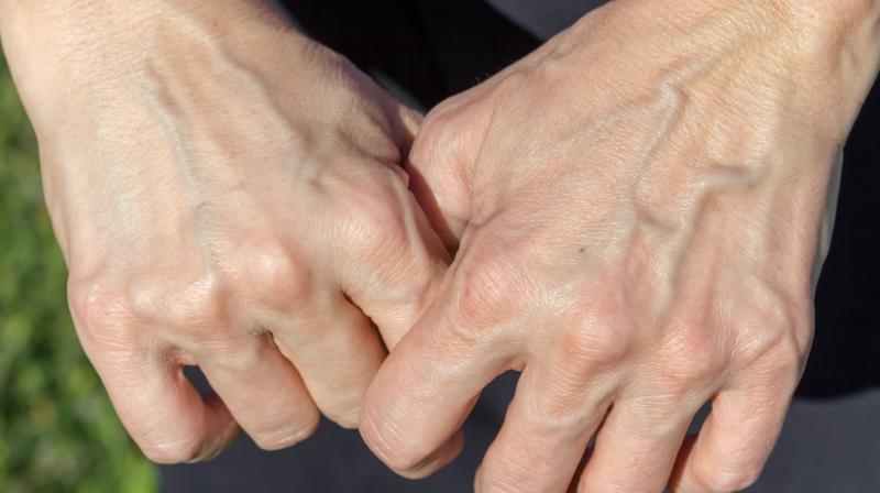 Image: For representation purpose only. 