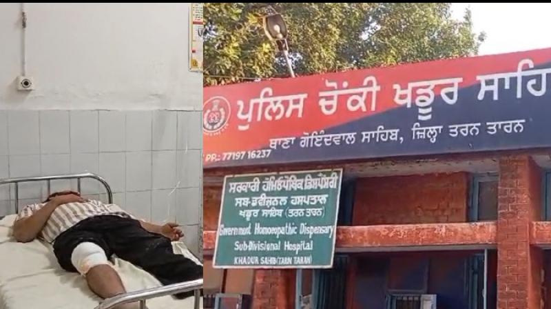  Gangster Kashmir Singh Seelu injured