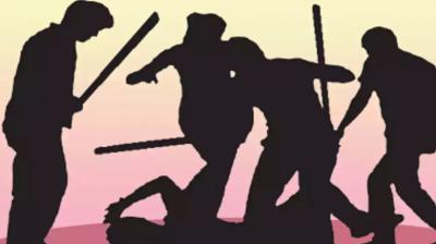 Representative Image.