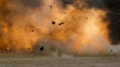 Representative Image.