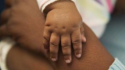 Representative Image.