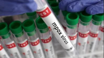 Representative Image.