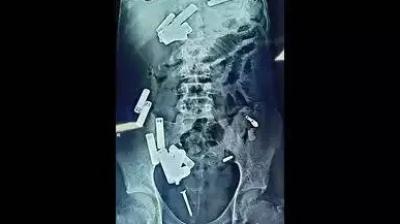 Representative Image.