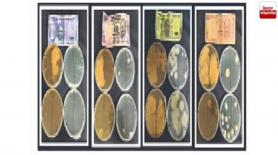 Notes are Dirty, Dangerous Fungus, Risk of TB in 10 to 100 Rupees Latest News in Punjabi 