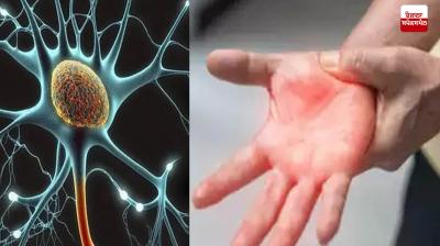 GBS Patients in Maharashtra News in punjabi 