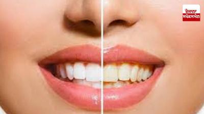 If you want to get rid of yellowness of teeth then follow this recipe