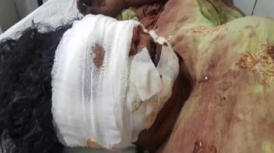 brother stabbed his sister's eyes