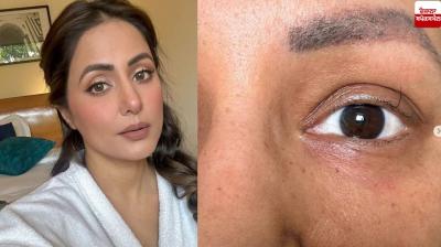 "My eyelid hair is standing with me", Hina Khan shared a picture after the last chemotherapy
