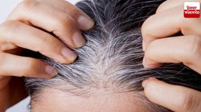 If your hair is starting to turn gray at a young age, then follow these home remedies Health News