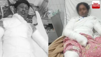 Khanna Girlfriend Boyfriend burnt News