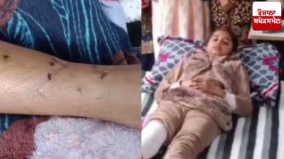 Prabhjot Kaur was badly mauled by stray dogs in Kaulpur