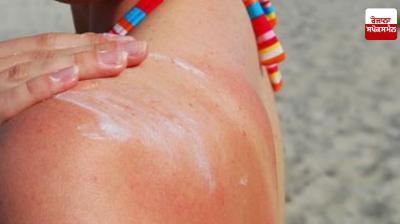 Home remedies for sun-tanned skin
