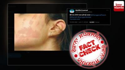 Old image from Baygon Slap advertisement viral as Kangana Face Slap marked by CISF Officer