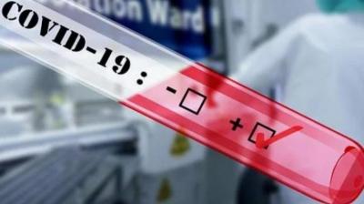 United states corona virus deaths covid 19 24 hours death data newyork