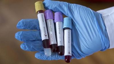 Coronavirus expert warns us double official figure