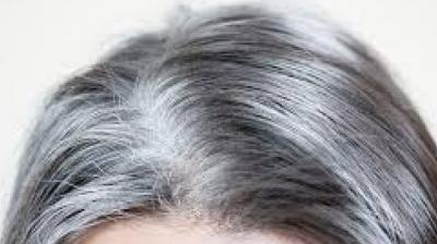White Hair