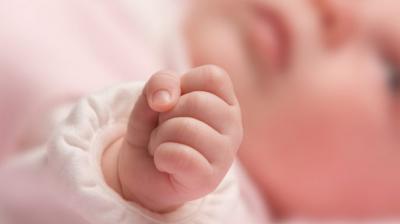 Doctors deliver baby girl grown inside abdominal skull instead of Uterus