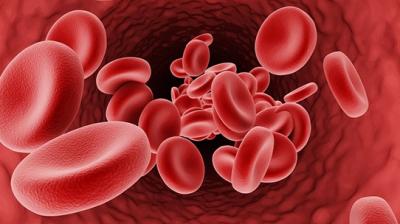 Thalassemia 